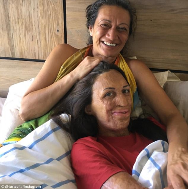 turia pitt and her mum