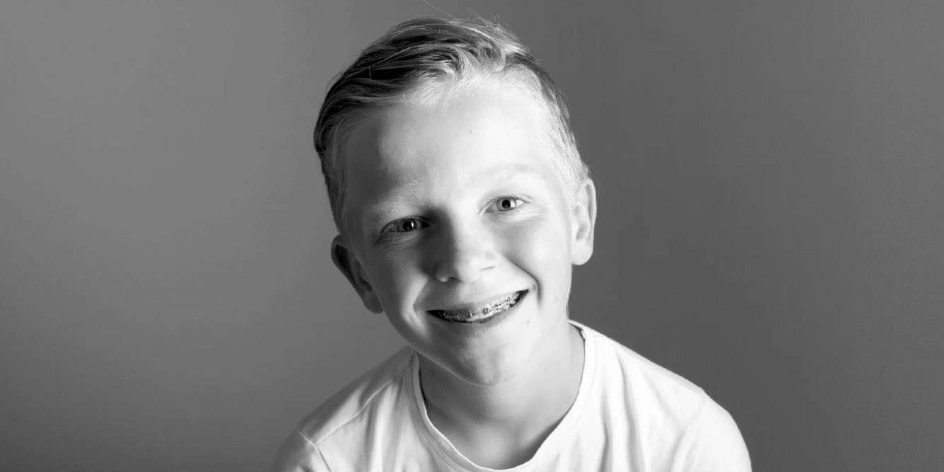 everything you need to know about braces