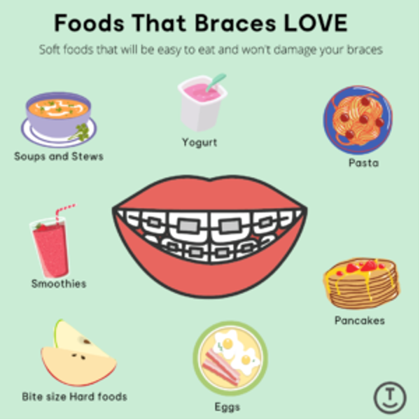 food ok for braces
